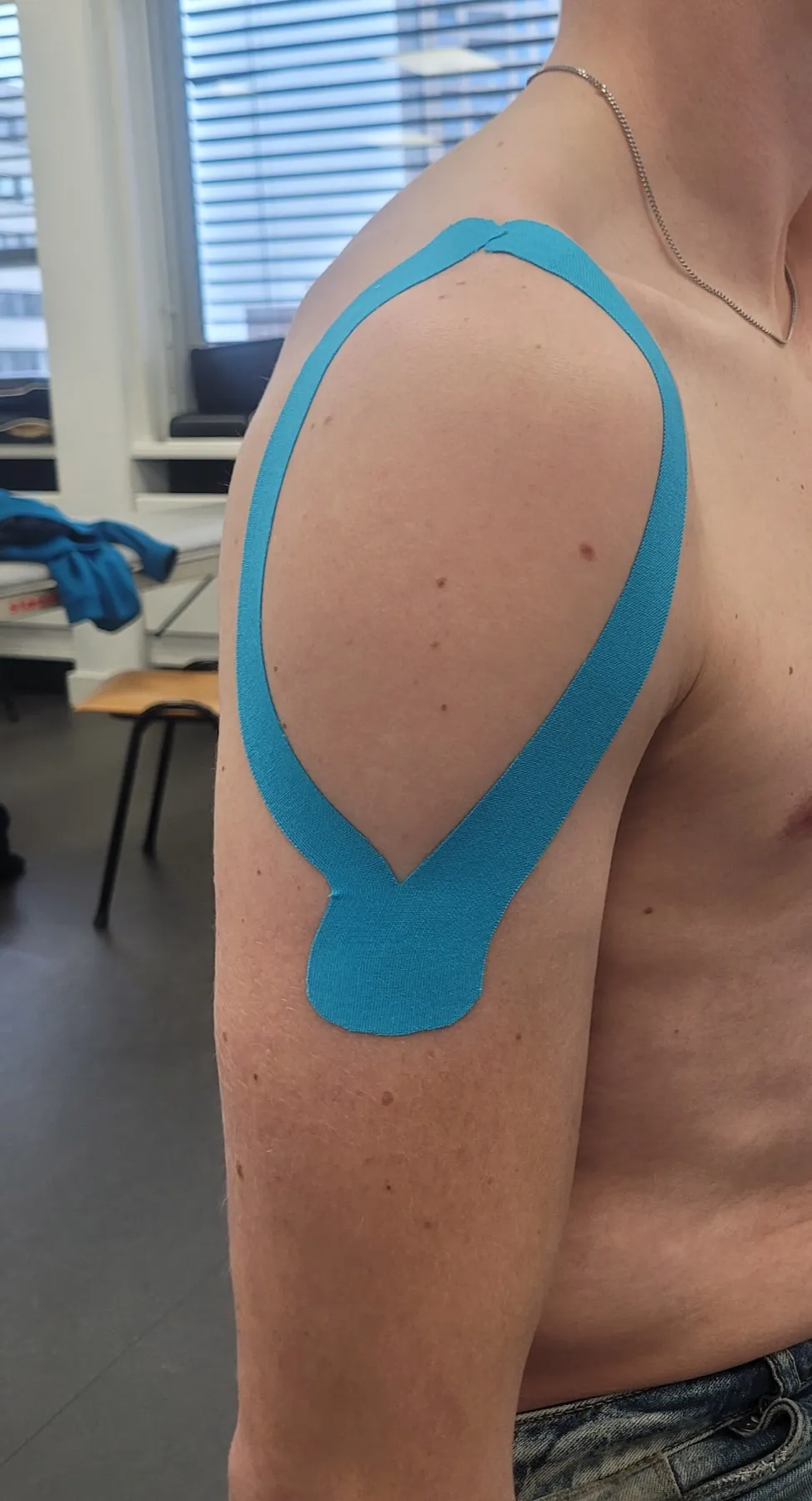 Medical taping aangebracht op een schouder